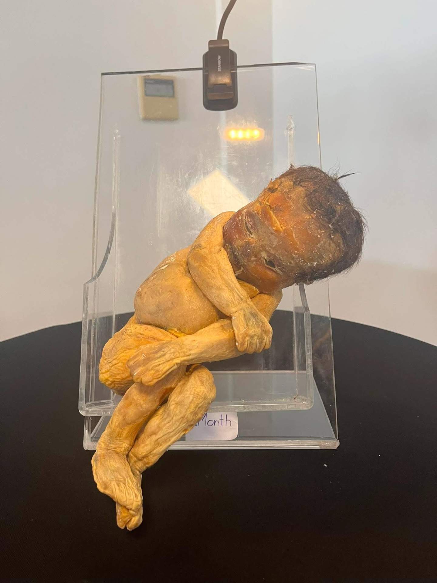 anatomia na żywo